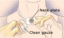 Drawing of a person cleaning the neck plate and skin with clean gauze.