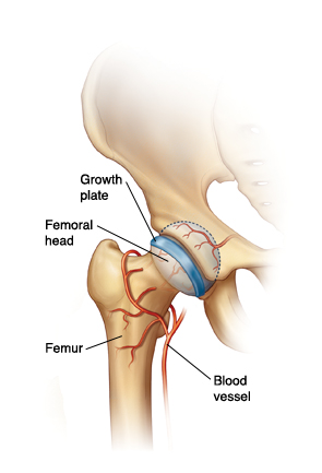 Closeup front view of hip joint showing femur and femoral head fitting into socket in pelvis. Blood vessels wrap around femur and go to femoral head. Growth plate is across femoral head.
