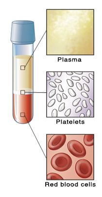 Vial of blood separated into parts, with closeups of plasma, platelets, and red blood cells.