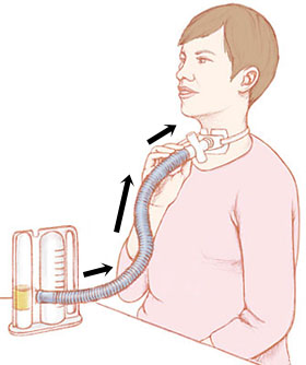 Woman with tip of incentive spirometer inserted into tracheostomy tube. Arrows show her breathing in.