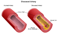Illustration of a carotid artery duplex scan