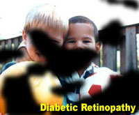 Simulation photograph: diabetic retinopathy