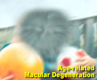 Simulation photograph: age-related macular degeneration