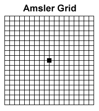 Illustration of Amsler grid