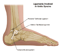 Illustration showing the three ligaments involved in ankle sprains/strains