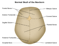 Anatomy of the Newborn Skull