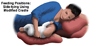 Illustration of breastfeeding, side-lying using modified cradle position