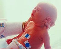 Picture of a newborn in the neonatal intensive care unit