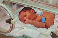 Picture of a baby in the neonatal intensive care unit