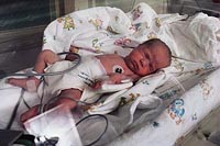 Picture of a newborn in the neonatal intensive care unit
