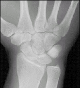 X-ray image.
