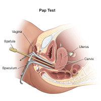 Illustration of a Pap test