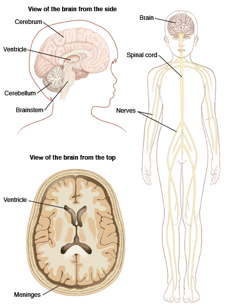 Outline of child's head turned to side showing brain structures. Cerebrum is main part of brain. Ventricle is fluid-filled space in center of brain. Cerebellum is part of brain at base of skull. Brainstem is at base of brain connecting to spinal cord. Second image showing cross section of brain in head with ventricles and meninges. Third image of child's outline showing brain in head, spinal cord going down center of body, and nerves branching to arms and legs.