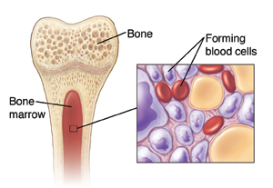 Cross-section of bone showing marrow and inset of blood components in marrow.