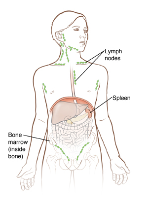 Outline of boy showing organs inside abdomen and outline of hip bone. Spleen is next to upper left curve of stomach. Lymph nodes are small ball-shaped organs in neck, around collarbone, in chest, in armpits, and in groin. Label points out bone marrow inside hip bone.