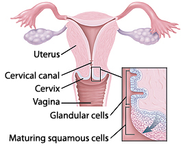 Cross section of uterus showing cervical canal in cervix and vagina. Closeup of cross section of cervix showing glandular cells in cervical canal and maturing squamous cells on outside of cervix.