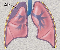 Cutaway view of lungs