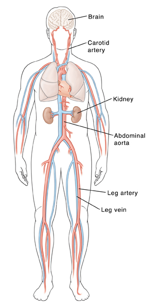 Male outline showing major blood vessels, brain, heart, lungs, and kidneys.