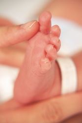 Photo of infant's foot