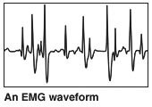 An EMG waveform