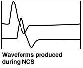 Waveforms produced during NCS