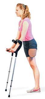 Woman with amputated leg holding crutches with tips in front of her.