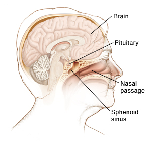 Side view of a female head showing the brain, pituitary gland, sphenoid sinus and nasal passage.