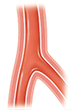 Cross section of healthy artery.