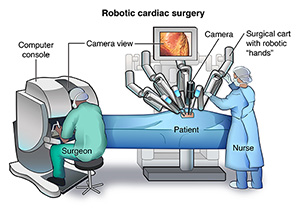 Surgeon, surgical robot, and nurse with patient in an operating suite
