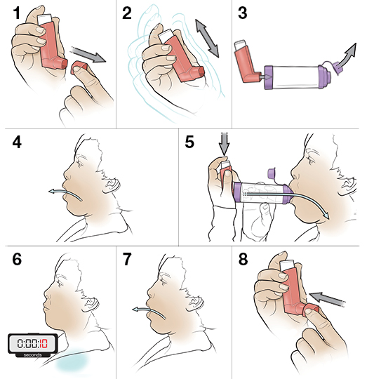 Step-by-Step: Using An Inhaler With A Spacer