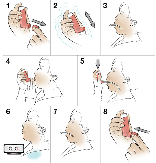 Step-by-Step: Using An Inhaler Without A Spacer