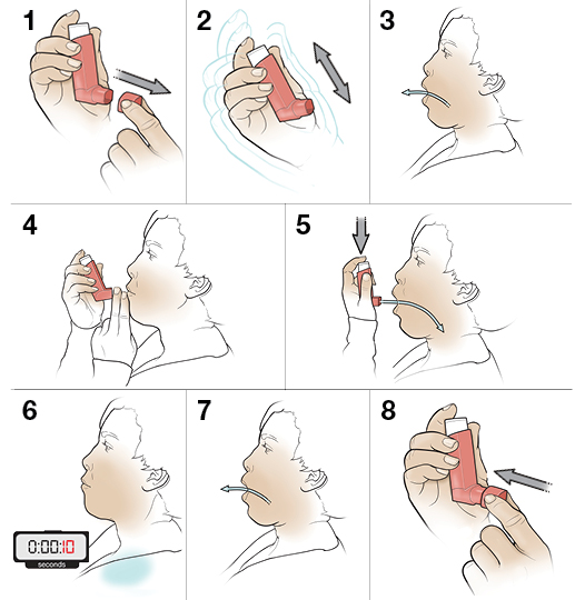 8 steps in using a metered-dose inhaler without a spacer