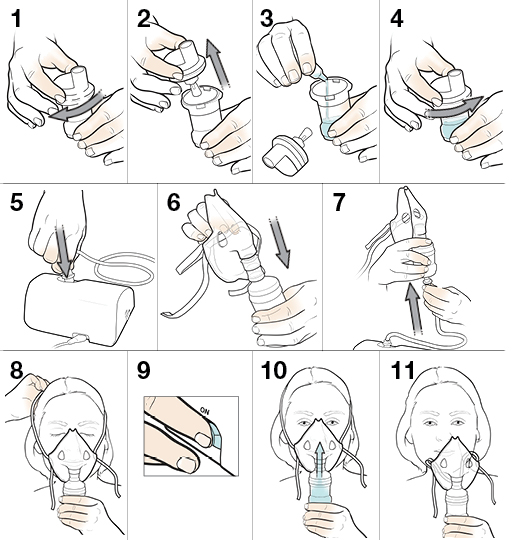 11 steps in using a nebulizer with a face mask