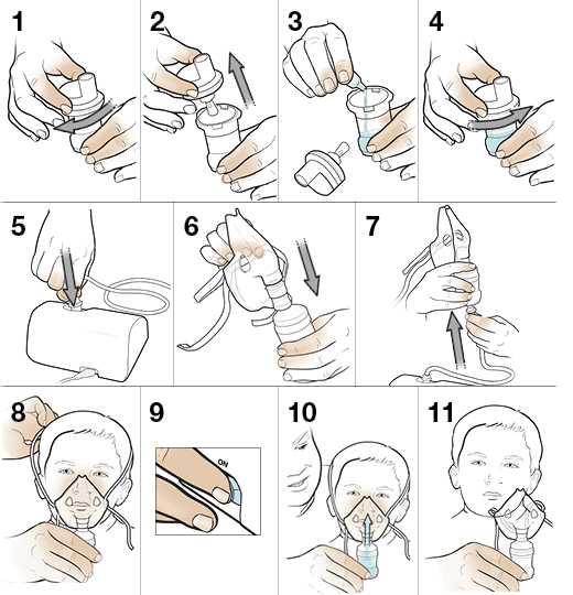 11 steps in using a nebulizer with a child