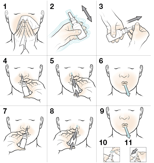 11 steps in using nasal spray