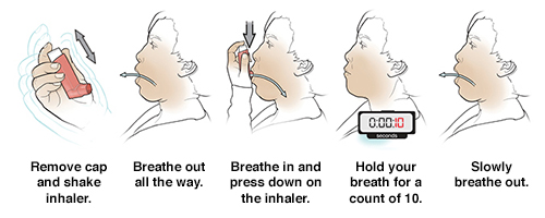 Discharge Instructions: Using A Metered-Dose Inhaler