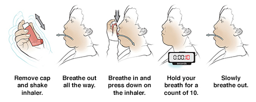 Five steps in using metered-dose inhaler without a spacer.