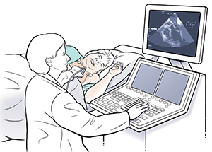 Woman lying on side on exam table with EKG leads on chest. Technician is holding ultrasound probe to woman's chest. 