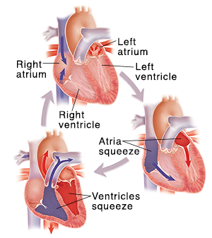 Diagram of three cross-sectioned hearts showing blood flow during heartbeats.
