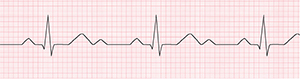 An ECG recording of a regular heartbeat.