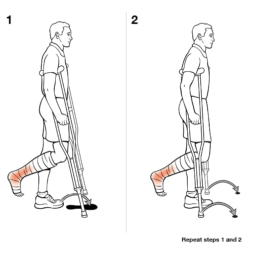 2 steps in using crutches with swing to (non-weight bearing)