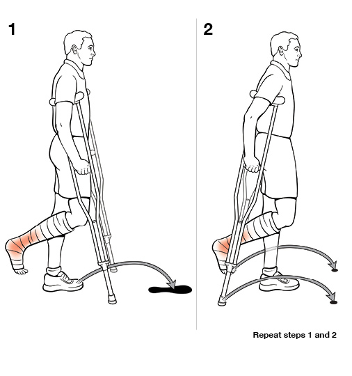 2 steps in using crutches with swing through (non-weight bearing)