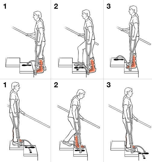 6 steps in using crutches on stairs.