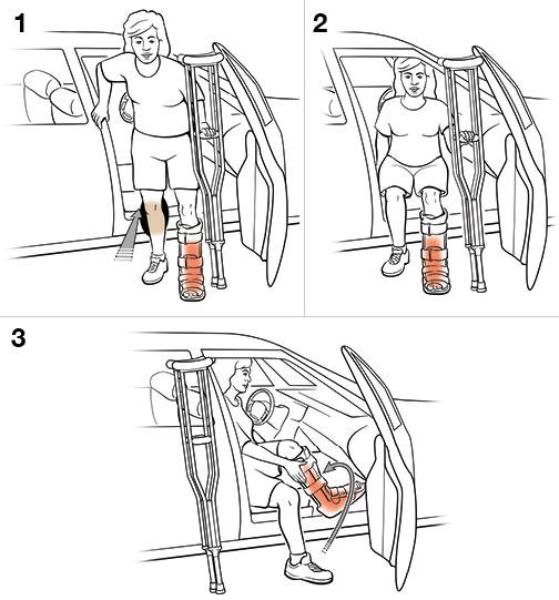 3 steps in getting into a car with crutches