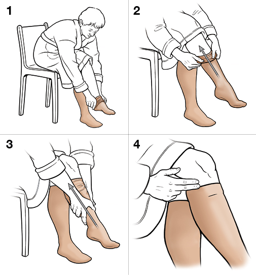 4 steps in putting on knee-high compression stockings