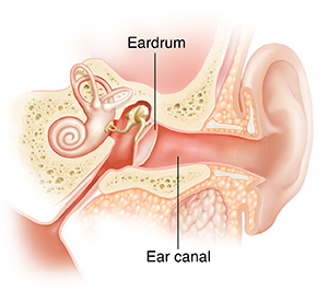 Swimmer’s ear is an irritation and infection of the ear canal. Cross section of child's ear showing outer, inner, and middle ear structures.