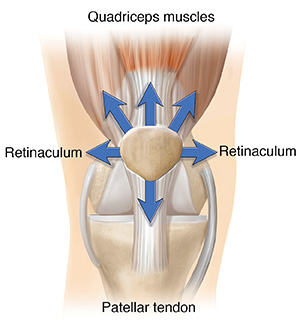 Front view of normal knee joint with arrows showing forces pulling evenly on patella.