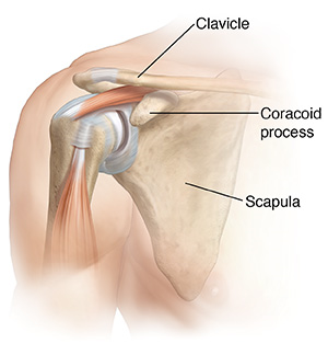 Front view of shoulder joint with muscles.