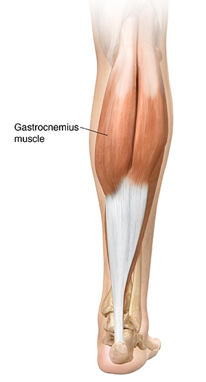 Back view of lower leg showing gastrocnemius muscle and Achilles tendon.
