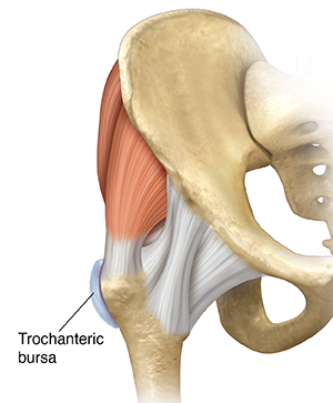 Front view of hip joint showing trochanteric bursa.